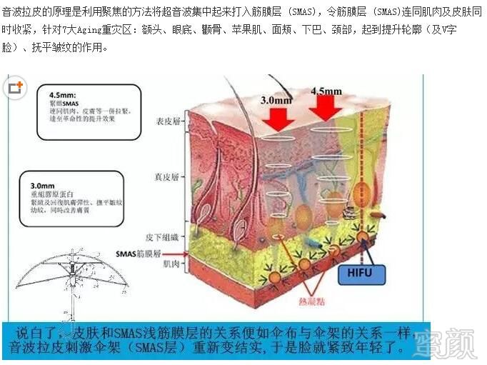 案例图片