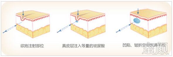 https://img.yiyiaimei.com/mnt/timg/170825/1AR4FM-1.jpg