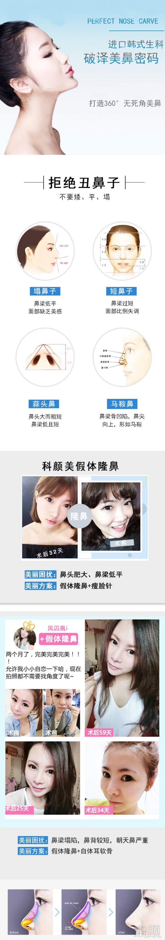 https://img.yiyiaimei.com/mnt/timg/170828/12514L634-0.jpg