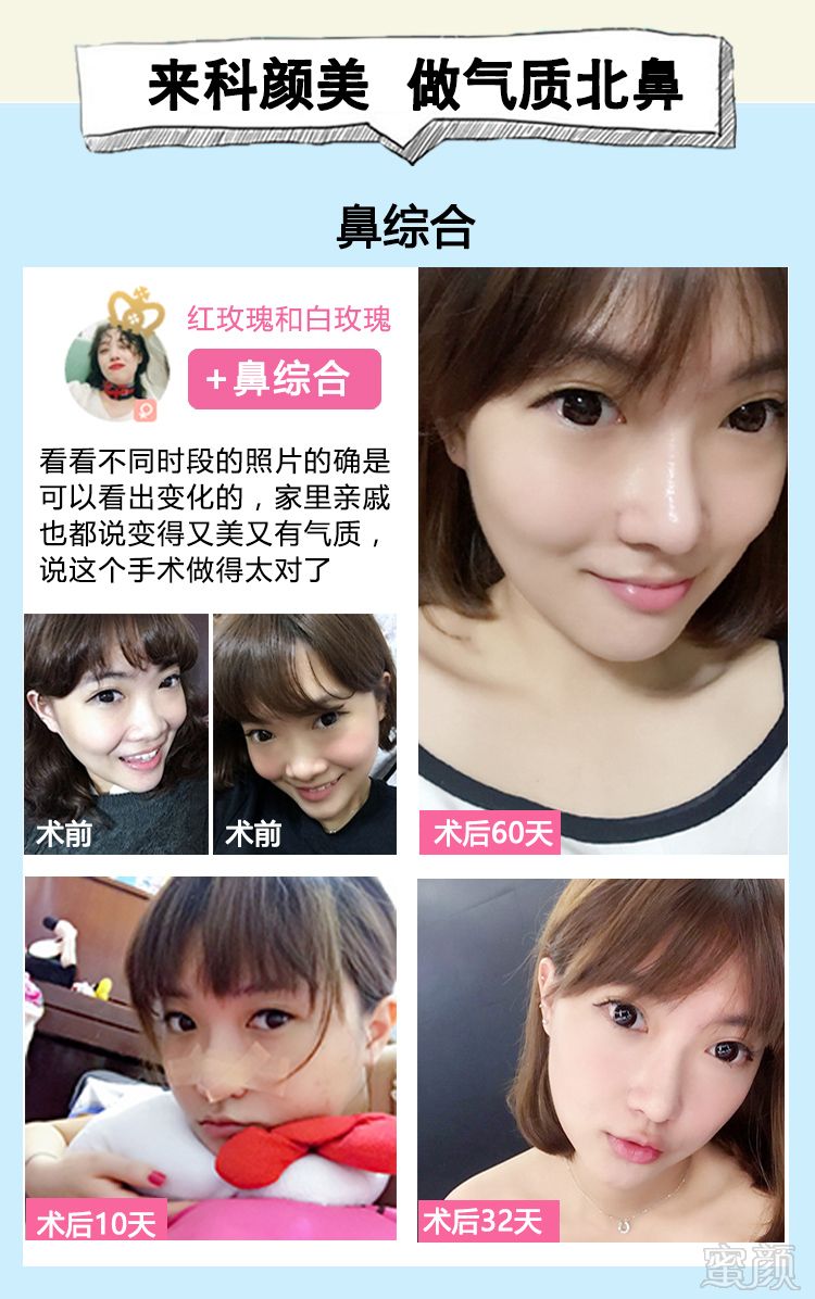 https://img.yiyiaimei.com/mnt/timg/170828/1311594T7-2.jpg