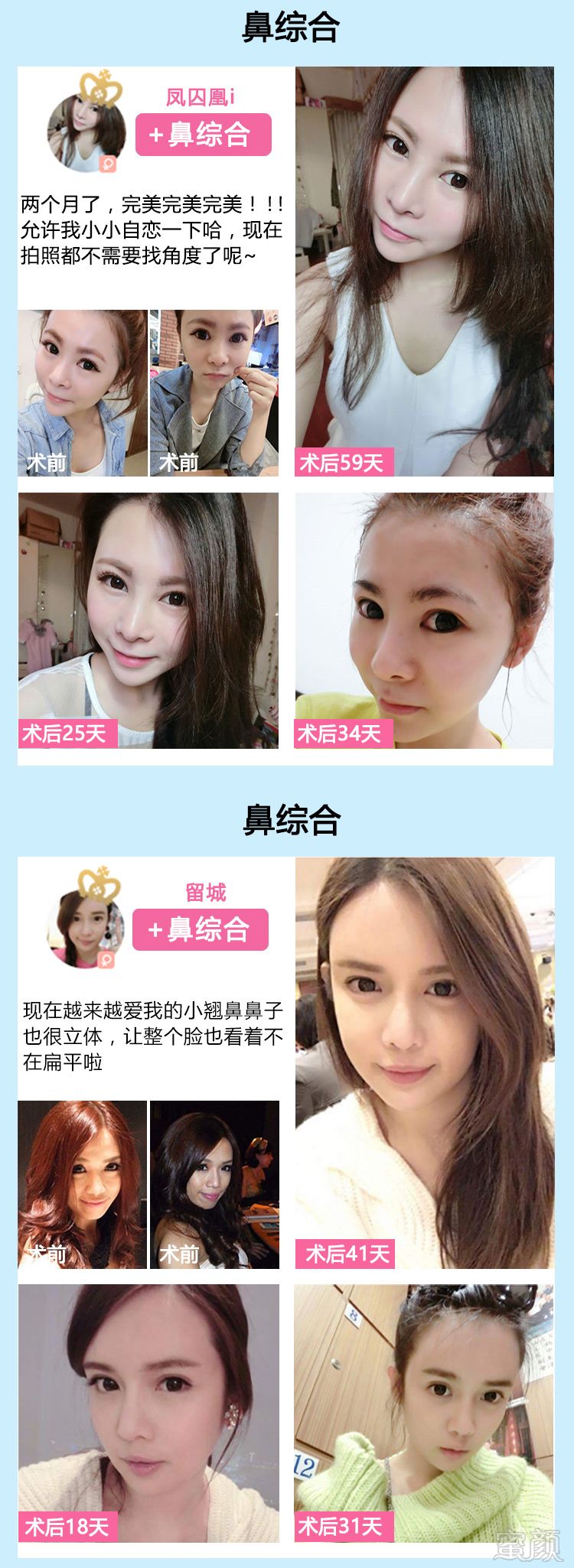 https://img.yiyiaimei.com/mnt/timg/170828/1312003013-3.jpg