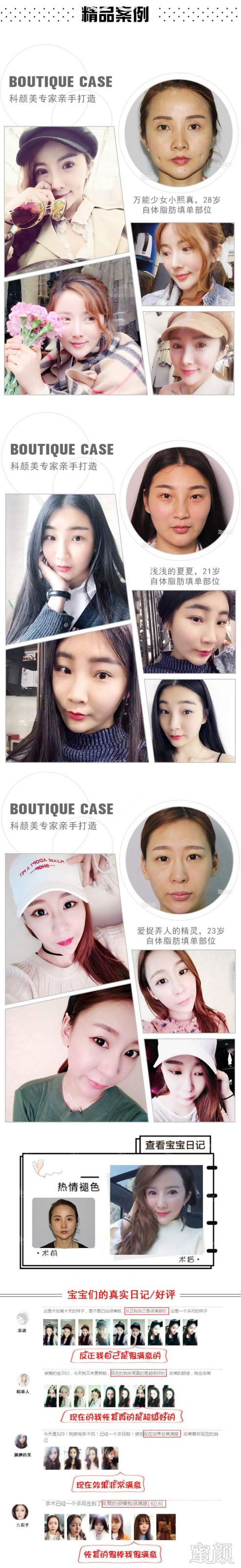 https://img.yiyiaimei.com/mnt/timg/170828/13335a4Z-0.jpg