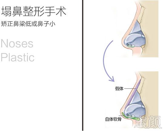 https://img.yiyiaimei.com/mnt/timg/170828/1553442408-0.jpg