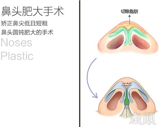 https://img.yiyiaimei.com/mnt/timg/170828/155345JF-2.jpg