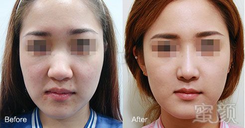 https://img.yiyiaimei.com/mnt/timg/170828/15534622X-3.jpg