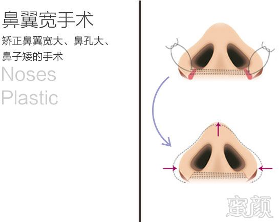 https://img.yiyiaimei.com/mnt/timg/170828/15534623X-4.jpg