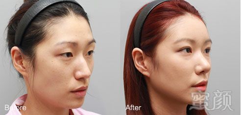 https://img.yiyiaimei.com/mnt/timg/170828/1553493D8-9.jpg