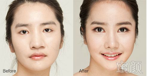 https://img.yiyiaimei.com/mnt/timg/170828/15534JQ6-5.jpg