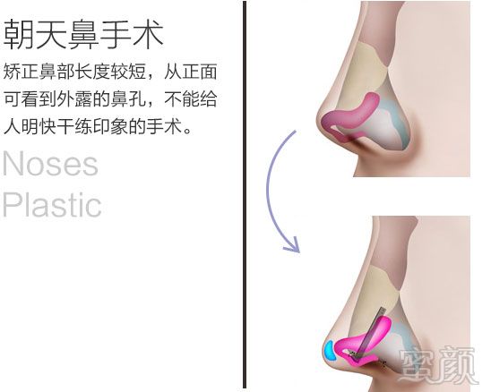 https://img.yiyiaimei.com/mnt/timg/170828/15534RK7-6.jpg