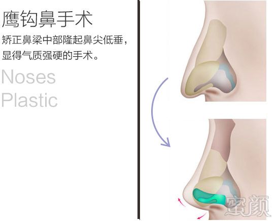 https://img.yiyiaimei.com/mnt/timg/170828/15534WD1-8.jpg