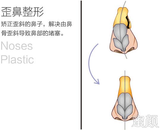 https://img.yiyiaimei.com/mnt/timg/170828/15535045N-10.jpg