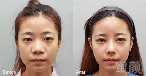 https://img.yiyiaimei.com/mnt/timg/170828/15535155L-13.jpg