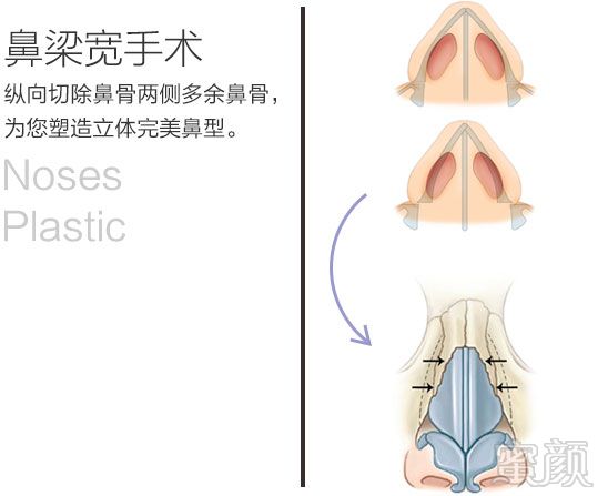 https://img.yiyiaimei.com/mnt/timg/170828/155351B01-12.jpg