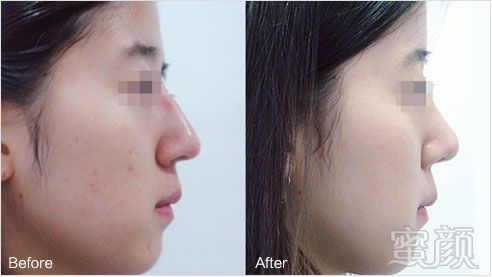 https://img.yiyiaimei.com/mnt/timg/170828/1553525K0-15.jpg