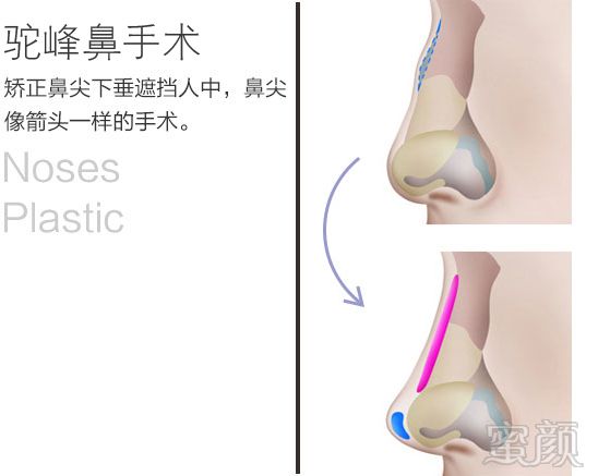 https://img.yiyiaimei.com/mnt/timg/170828/155352EO-14.jpg