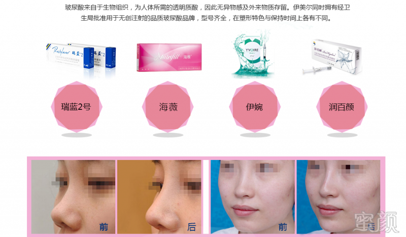 https://img.yiyiaimei.com/mnt/timg/170828/16105633F-1.jpg
