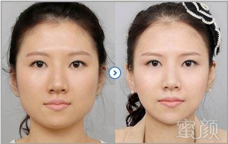 案例图片