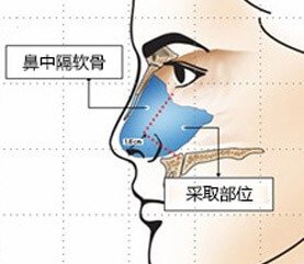 案例图片