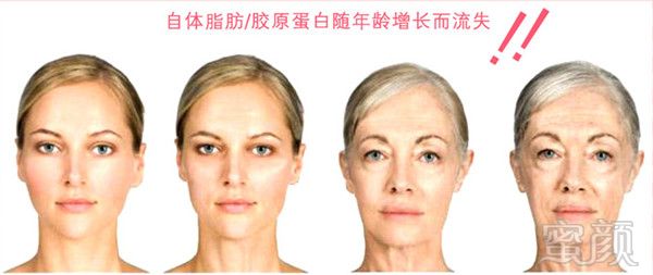 https://img.yiyiaimei.com/mnt/timg/170901/1K40451b-2.jpg