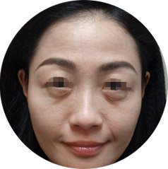 案例图片