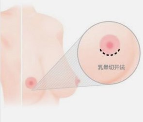 案例图片