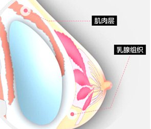 案例图片