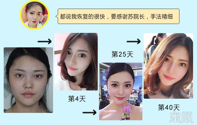 https://img.yiyiaimei.com/mnt/timg/170906/1T3492038-7.jpg
