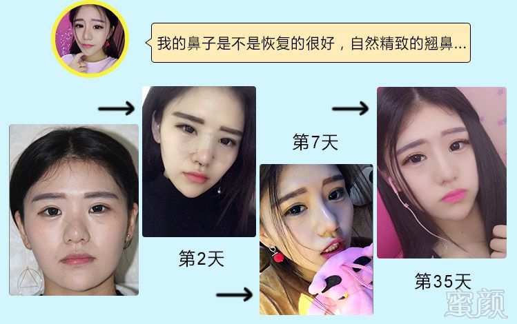 https://img.yiyiaimei.com/mnt/timg/170906/1T34923N-6.jpg