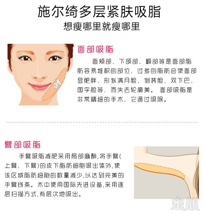 案例图片