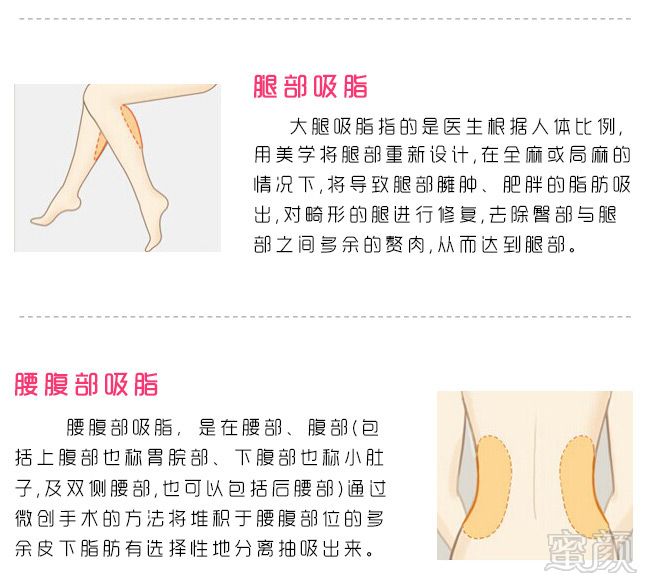 案例图片
