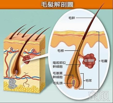 案例图片