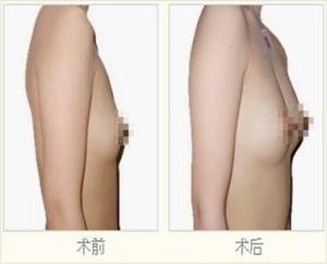 案例图片