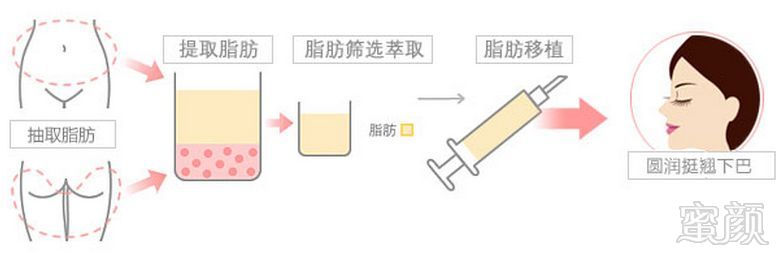 https://img.yiyiaimei.com/mnt/timg/170911/1421045163-0.jpg