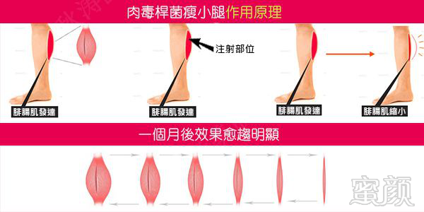 案例图片