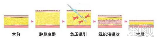 案例图片