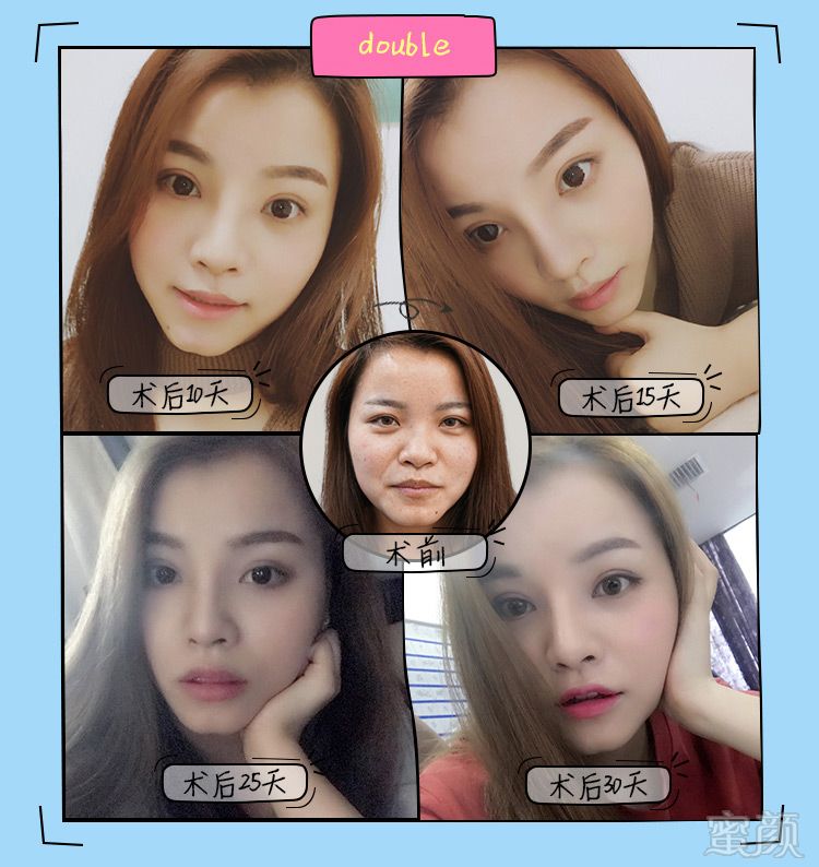 案例图片