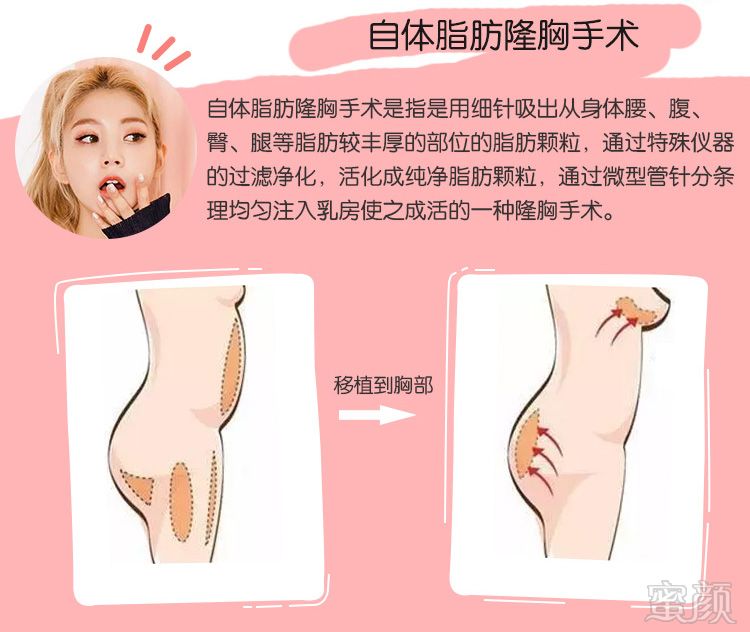 案例图片