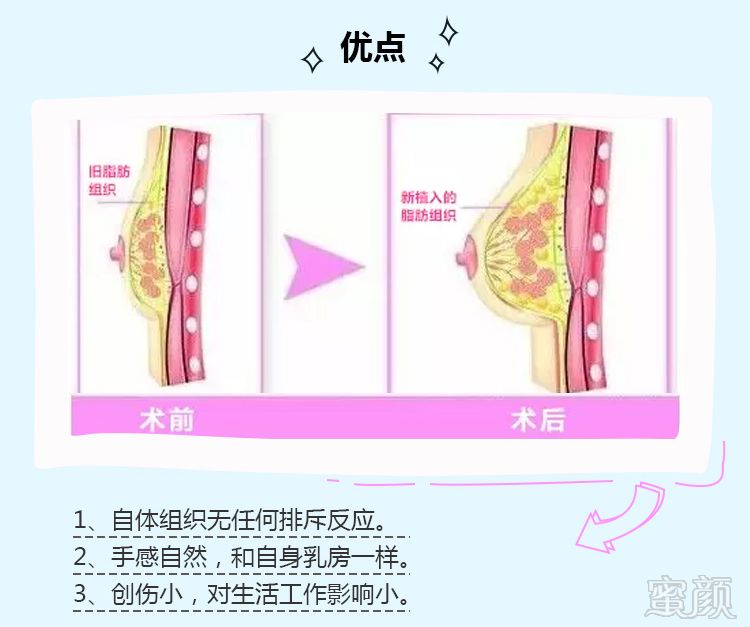 案例图片