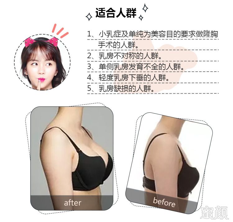 案例图片