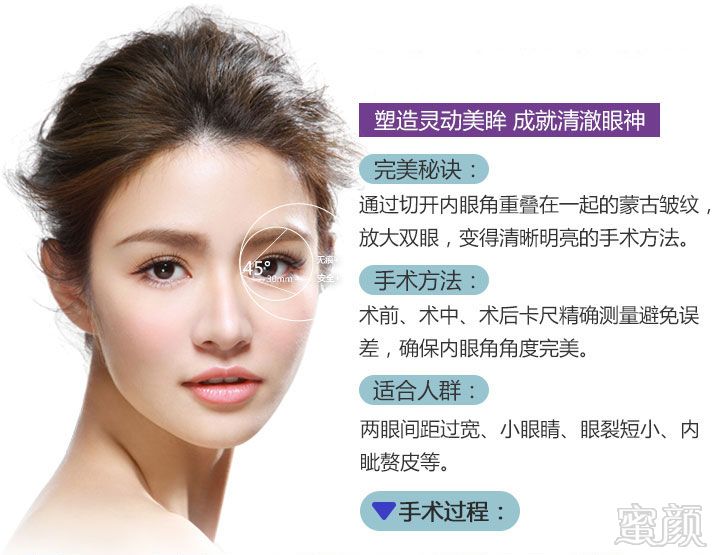 案例图片