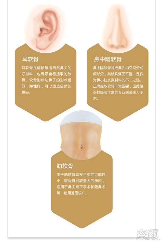 https://img.yiyiaimei.com/mnt/timg/170915/1042423008-4.jpg