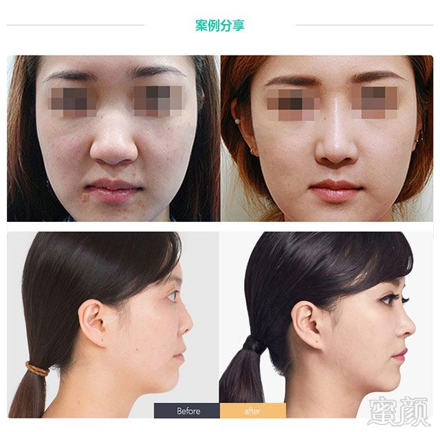 https://img.yiyiaimei.com/mnt/timg/170915/10424243E-6.jpg