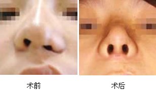 案例图片