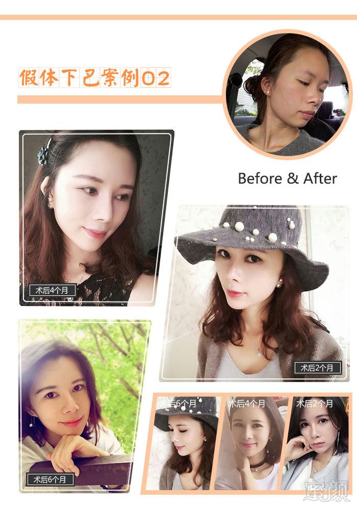 案例图片