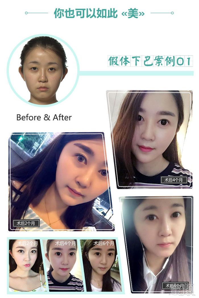 案例图片