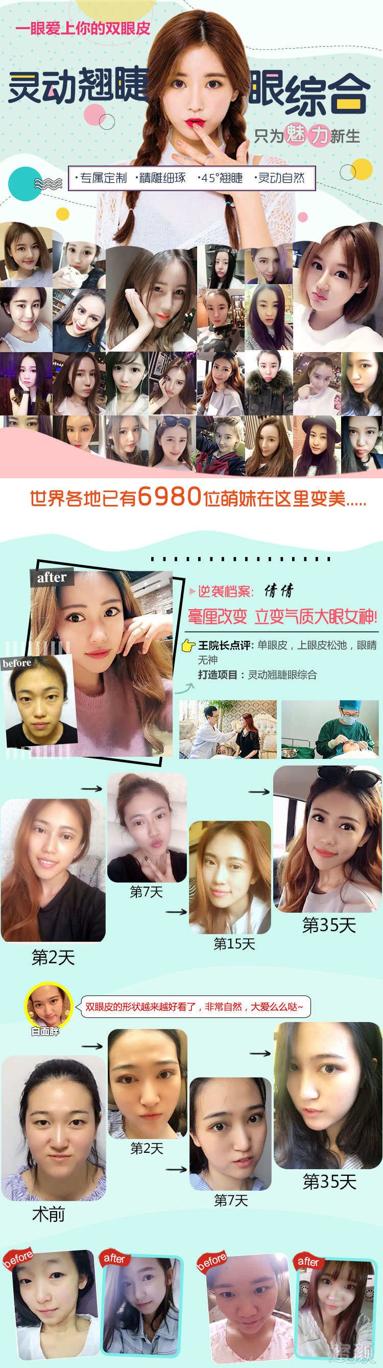 案例图片