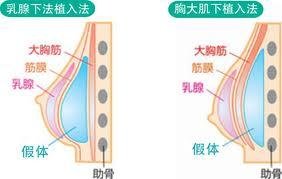 案例图片