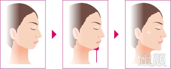 https://img.yiyiaimei.com/mnt/timg/171215/00133053W-1.jpg