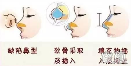 https://img.yiyiaimei.com/mnt/timg/190103/1P6153W1-3.jpg