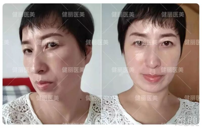 案例图片
